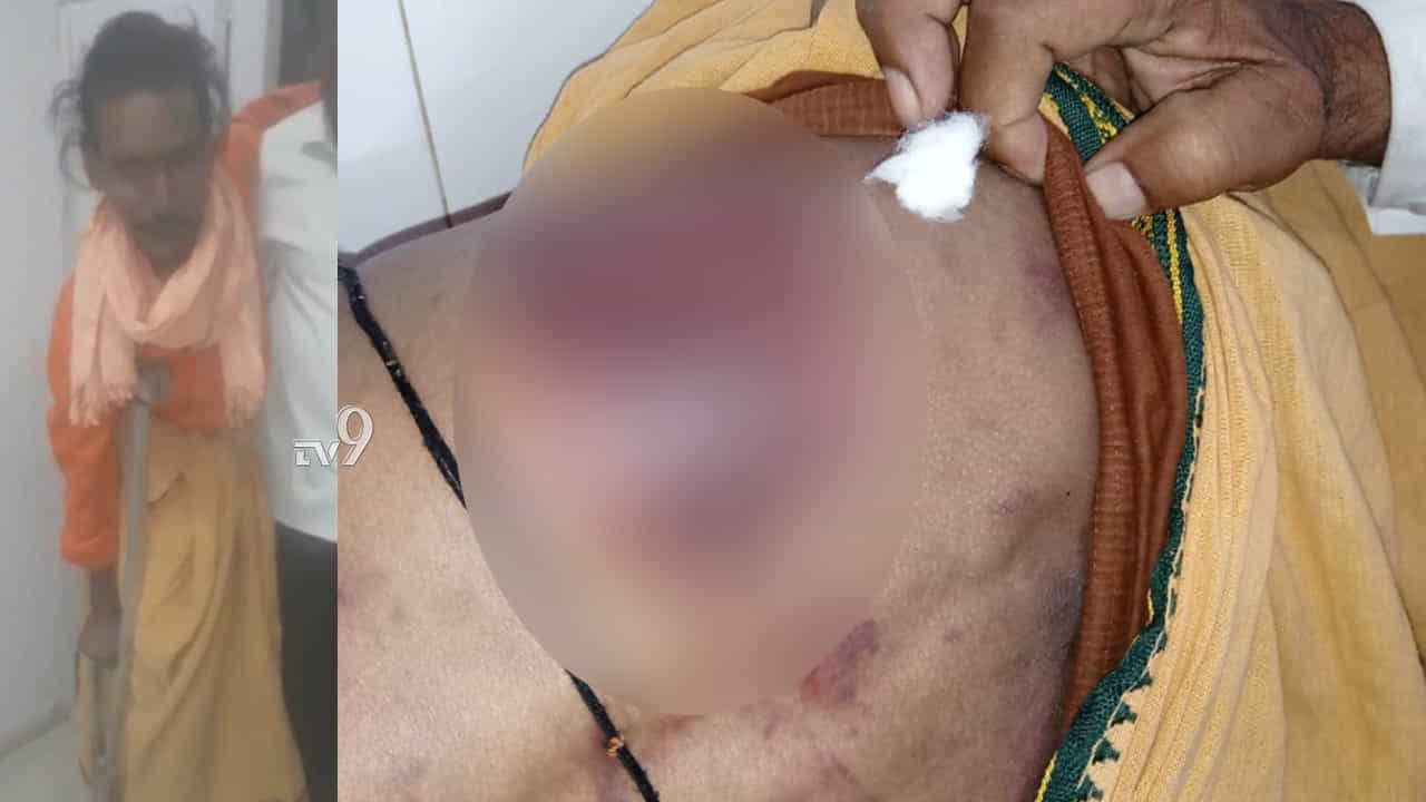 ಸ್ವಾಮೀಜಿಗೆ ಬಾಸುಂಡೆ ಬರೋಹಾಗೆ ಥಳಿಸಿದ್ರಾ ಪೇದೆ? ಸ್ವಾಮೀಜಿಗೆ ಬಾಸುಂಡೆ ಬರೋಹಾಗೆ ಥಳಿಸಿದ್ರಾ ಪೇದೆ?