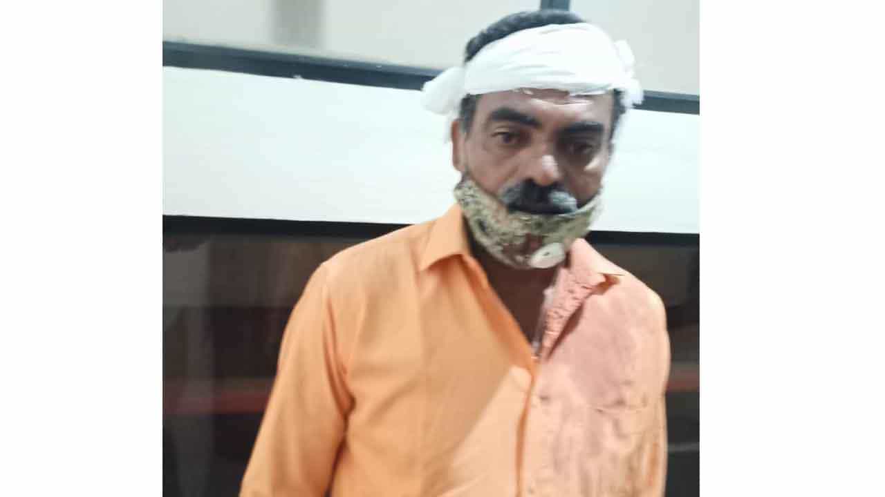 ಕ್ಷುಲ್ಲಕ ಕಾರಣಕ್ಕೆ ಮಚ್ಚಿನಿಂದ ಮಾಜಿ ಉಪಮೇಯರ್ ಮೇಲೆ ಹಲ್ಲೆ.. ಎಲ್ಲಿ? ಕ್ಷುಲ್ಲಕ ಕಾರಣಕ್ಕೆ ಮಚ್ಚಿನಿಂದ ಮಾಜಿ ಉಪಮೇಯರ್ ಮೇಲೆ ಹಲ್ಲೆ.. ಎಲ್ಲಿ?