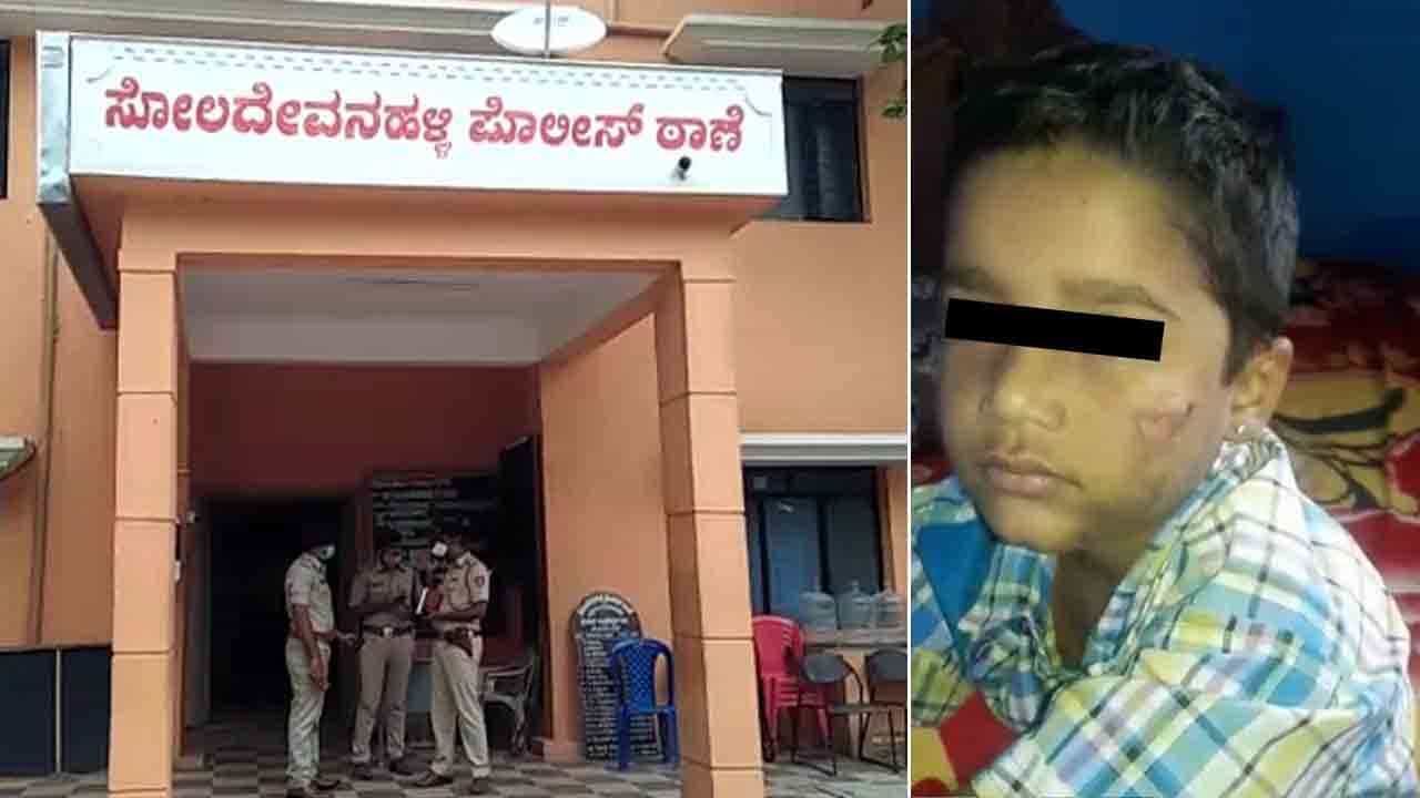 ಮನೆ ಮುಂದೆ ಆಟವಾಡ್ತಿದ್ದ ಬಾಲಕನಿಗೆ ದೋಸೆ ಎತ್ತುವ ಮೊಗಚೆ ಕೈನಿಂದ ಬರೆ ಮನೆ ಮುಂದೆ ಆಟವಾಡ್ತಿದ್ದ ಬಾಲಕನಿಗೆ ದೋಸೆ ಎತ್ತುವ ಮೊಗಚೆ ಕೈನಿಂದ ಬರೆ