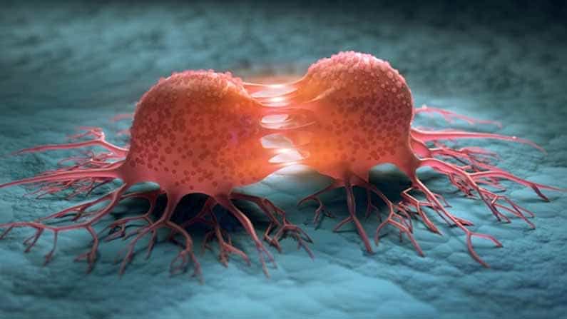 World Cancer Day 2021 ಕ್ಯಾನ್ಸರ್ಗೆ ಕಾರಣಗಳು ಒಂದೆರಡಲ್ಲ.. ಬೊಜ್ಜು, ಅತಿಯಾದ ತೂಕದಿಂದಲೂ ಅಪಾಯ !