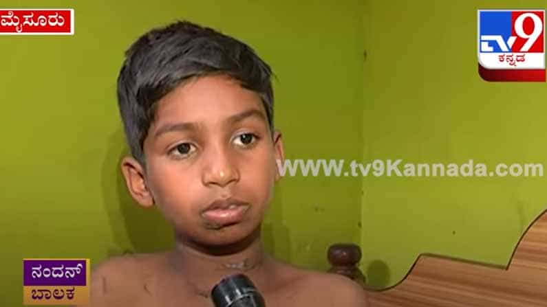 ಚಿರತೆಯೊಂದಿಗೆ ಧೈರ್ಯದಿಂದ ಹೋರಾಡಿ, ಅದರ ಕಣ್ಣಿಗೆ ತಿವಿದು ಪಾರಾದ ಬಾಲಕ !