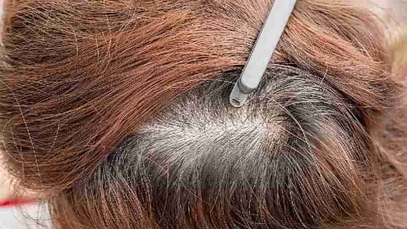 ಕ್ಯಾನ್ಸರ್ ರೋಗಿಗಳಿಗೆ ಕೂದಲು ದಾನ ಮಾಡಿದ ಎರಡು ವರ್ಷದ ಬಾಲಕ!