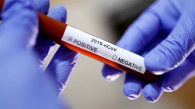 Coronavirus in India: ಇಂದು ದೇಶದಲ್ಲಿ 28 ಸಾವಿರಕ್ಕೂ ಅಧಿಕ ಕೊರೊನಾ ಪ್ರಕರಣಗಳು ಪತ್ತೆ; ಈ ಪಂಚರಾಜ್ಯಗಳಲ್ಲೇ ಸೋಂಕು ಹೆಚ್ಚು