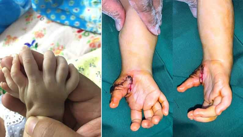 DR BHASKARANANDA KUMAR UDUPI HAND SURGERY