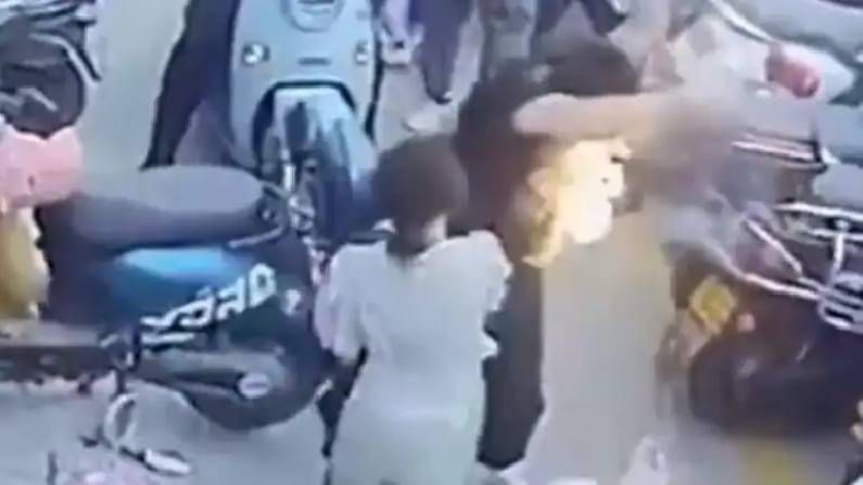 Viral Video: ಬ್ಯಾಗ್ನಲ್ಲಿದ್ದ ಮೊಬೈಲ್ನಲ್ಲಿ ಬೆಂಕಿ; ಕೈ, ತಲೆಕೂದಲು ಸುಟ್ಟುಕೊಂಡ ಯುವಕ
