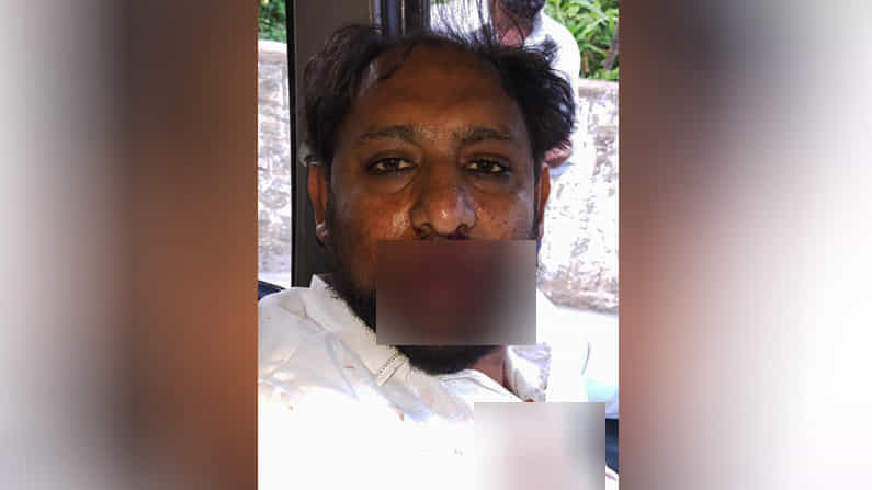 ಬೆಂಗಳೂರಿನಲ್ಲಿ ಅಂತ್ಯಕ್ರಿಯೆಗೆ ಹಣ ನೀಡುವ ವಿಚಾರಕ್ಕೆ ಮಾರಣಾಂತಿಕ ಹಲ್ಲೆ ಬೆಂಗಳೂರಿನಲ್ಲಿ ಅಂತ್ಯಕ್ರಿಯೆಗೆ ಹಣ ನೀಡುವ ವಿಚಾರಕ್ಕೆ ಮಾರಣಾಂತಿಕ ಹಲ್ಲೆ