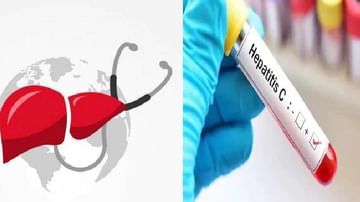 World Hepatitis Day 2021: ಹೆಪಟೈಟಿಸ್ ಸೋಂಕು ಪಿತ್ತಜನಕಾಂಗಕ್ಕೆ ಹಾನಿಕಾರಕ; ಮುನ್ನೆಚ್ಚರಿಕೆಯ ಬಗ್ಗೆ ಗಮನಹರಿಸಿ