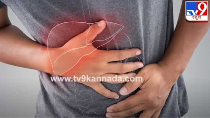 ಹೆಪಟೈಟಿಸ್ ಎ ಸೋಂಕಿನ ಬಗ್ಗೆ ನಿಮಗೆಷ್ಟು ಗೊತ್ತು? ಈ ಕಾಯಿಲೆ ಅದೆಷ್ಟು ಅಪಾಯಕಾರಿ? ಹೆಪಟೈಟಿಸ್ ಎ ಸೋಂಕಿನ ಬಗ್ಗೆ ನಿಮಗೆಷ್ಟು ಗೊತ್ತು? ಈ ಕಾಯಿಲೆ ಅದೆಷ್ಟು ಅಪಾಯಕಾರಿ?