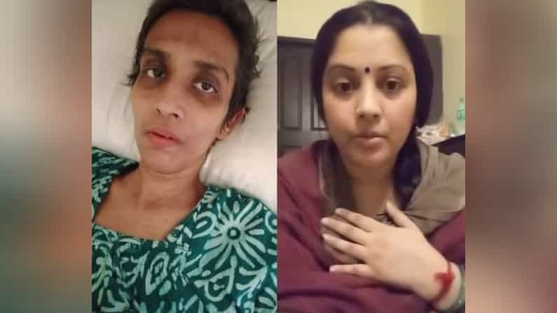 ಸಹೋದರಿ ಉಷಾ ಅವರ ಪರಿಸ್ಥಿತಿಯನ್ನು ವಿವರಿಸುತ್ತಾ ಕಣ್ಣೀರು ಹಾಕಿದ ವಿಜಯಲಕ್ಷ್ಮಿ ಸಹೋದರಿ ಉಷಾ ಅವರ ಪರಿಸ್ಥಿತಿಯನ್ನು ವಿವರಿಸುತ್ತಾ ಕಣ್ಣೀರು ಹಾಕಿದ ವಿಜಯಲಕ್ಷ್ಮಿ