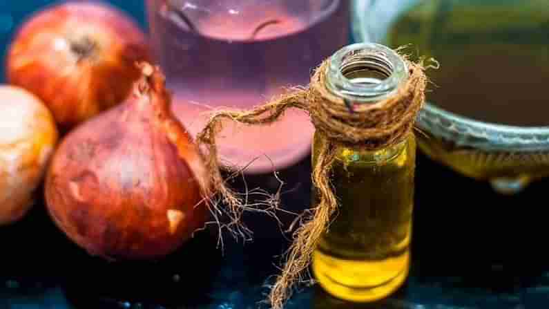 Onion Hair Oil: ಈರುಳ್ಳಿಯಿಂದ ಕೂದಲಿಗೆ ಇಷ್ಟೆಲ್ಲಾ ಪ್ರಯೋಜನಗಳಿವೆ ಎಂದು ಯೋಚಿಸಿದ್ದೀರಾ?