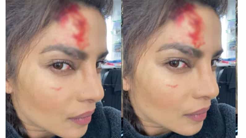 ಸೆಟ್ನಲ್ಲಿ ಗಾಯಗೊಂಡ ಪ್ರಿಯಾಂಕಾ ಚೋಪ್ರಾ; ರಕ್ತದಲ್ಲಿ ತೊಯ್ದ ಹಣೆ, ನಿಜ ಯಾವುದು ಎಂದು ಕೇಳಿದ ನಟಿ ಸೆಟ್ನಲ್ಲಿ ಗಾಯಗೊಂಡ ಪ್ರಿಯಾಂಕಾ ಚೋಪ್ರಾ; ರಕ್ತದಲ್ಲಿ ತೊಯ್ದ ಹಣೆ, ನಿಜ ಯಾವುದು ಎಂದು ಕೇಳಿದ ನಟಿ
