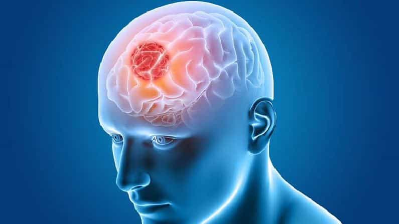 Brain Tumor: ಬ್ರೈನ್ ಟ್ಯೂಮರ್ ಕಾಯಿಲೆಯ ಬಗ್ಗೆ ಸುಳ್ಳು ವರದಿಗಳನ್ನು ನಂಬುವ ಮುನ್ನ ಸತ್ಯಾಸತ್ಯತೆ ಬಗ್ಗೆ ಅರಿಯುವುದು ಸೂಕ್ತ