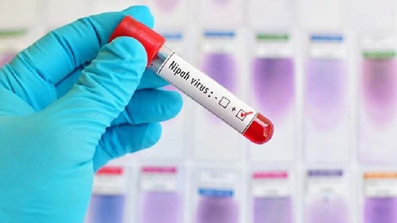Nipah Virus: ಕೊವಿಡ್ಗಿಂತಲೂ ಅಪಾಯಕಾರಿಯಾಗಿರುವ ನಿಫಾ ವೈರಸ್ ಬಗ್ಗೆ ನಿಮಗೆಷ್ಟು ಗೊತ್ತು? Nipah Virus: ಕೊವಿಡ್ಗಿಂತಲೂ ಅಪಾಯಕಾರಿಯಾಗಿರುವ ನಿಫಾ ವೈರಸ್ ಬಗ್ಗೆ ನಿಮಗೆಷ್ಟು ಗೊತ್ತು?