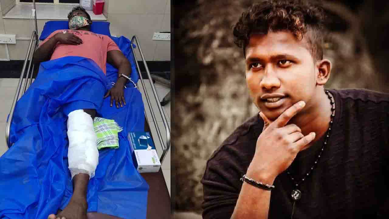 ಸ್ಥಳ ಮಹಜರು ವೇಳೆ ಹಲ್ಲೆ ನಡೆಸಿ ಪರಾರಿಗೆ ಯತ್ನಿಸಿದ ಕೊಲೆ ಆರೋಪಿ ಕಾಲಿಗೆ ಗುಂಡು, ಆರೋಪಿ ಮತ್ತು ಮುಖ್ಯಪೇದೆಗೆ ಆಸ್ಪತ್ರೆಯಲ್ಲಿ ಚಿಕಿತ್ಸೆ ಸ್ಥಳ ಮಹಜರು ವೇಳೆ ಹಲ್ಲೆ ನಡೆಸಿ ಪರಾರಿಗೆ ಯತ್ನಿಸಿದ ಕೊಲೆ ಆರೋಪಿ ಕಾಲಿಗೆ ಗುಂಡು, ಆರೋಪಿ ಮತ್ತು ಮುಖ್ಯಪೇದೆಗೆ ಆಸ್ಪತ್ರೆಯಲ್ಲಿ ಚಿಕಿತ್ಸೆ