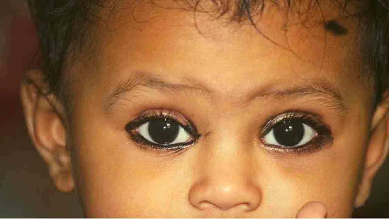 Children Eye Health: ಮಕ್ಕಳ ಕಣ್ಣಿಗೆ ಕಪ್ಪು ಕಾಡಿಗೆ ಹಚ್ಚುವುದು ಆರೋಗ್ಯದ ದೃಷ್ಟಿಯಿಂದ ಎಷ್ಟು ಸುರಕ್ಷಿತ?