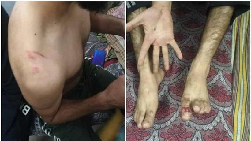 ಪಾಕ್ ವಿರುದ್ಧ ಭಾರತ ಪಂದ್ಯ ಸೋತ ಹಿನ್ನೆಲೆ; ಕಾಶ್ಮೀರಿ ವಿದ್ಯಾರ್ಥಿಗಳ ಮೇಲೆ ಪಂಜಾಬ್ನಲ್ಲಿ ಹಲ್ಲೆ