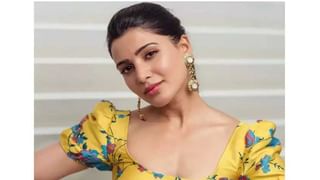 ಶಸ್ತ್ರಚಿಕಿತ್ಸೆಗೆ ಒಳಗಾದ ಮೆಗಾಸ್ಟಾರ್​ ಚಿರಂಜೀವಿ; ಚಿಂತೆಗೊಳಗಾದ ಫ್ಯಾನ್ಸ್​