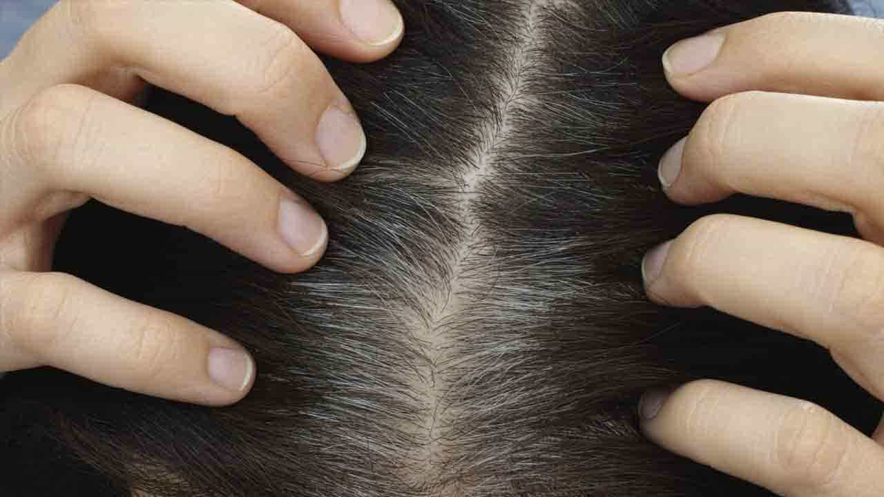 Hair Care Tips: ಕೂದಲು ಬೆಳ್ಳಗಾಗುತ್ತಿದೆಯೇ? ಪರಿಹಾರಕ್ಕೆ ಈ ಕೆಲವು ಸರಳ ಮಾರ್ಗಗಳನ್ನು ಅನುಸರಿಸಿ Hair Care Tips: ಕೂದಲು ಬೆಳ್ಳಗಾಗುತ್ತಿದೆಯೇ? ಪರಿಹಾರಕ್ಕೆ ಈ ಕೆಲವು ಸರಳ ಮಾರ್ಗಗಳನ್ನು ಅನುಸರಿಸಿ