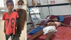 RIMS Hospital: ಮೈಯೆಲ್ಲಾ ಕೀವು, ವಿರಳ ಕಾಯಿಲೆಗೆ ಉಚಿತ ಚಿಕಿತ್ಸೆ ಕೊಟ್ಟು ಬಾಲಕನ ಜೀವ ಉಳಿಸಿದ ರಿಮ್ಸ್ ಆಸ್ಪತ್ರೆ ವೈದ್ಯರು