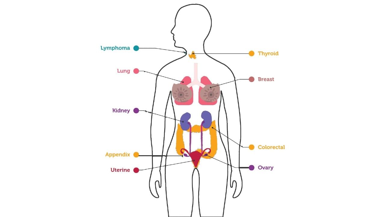 Cancer Types Human Body