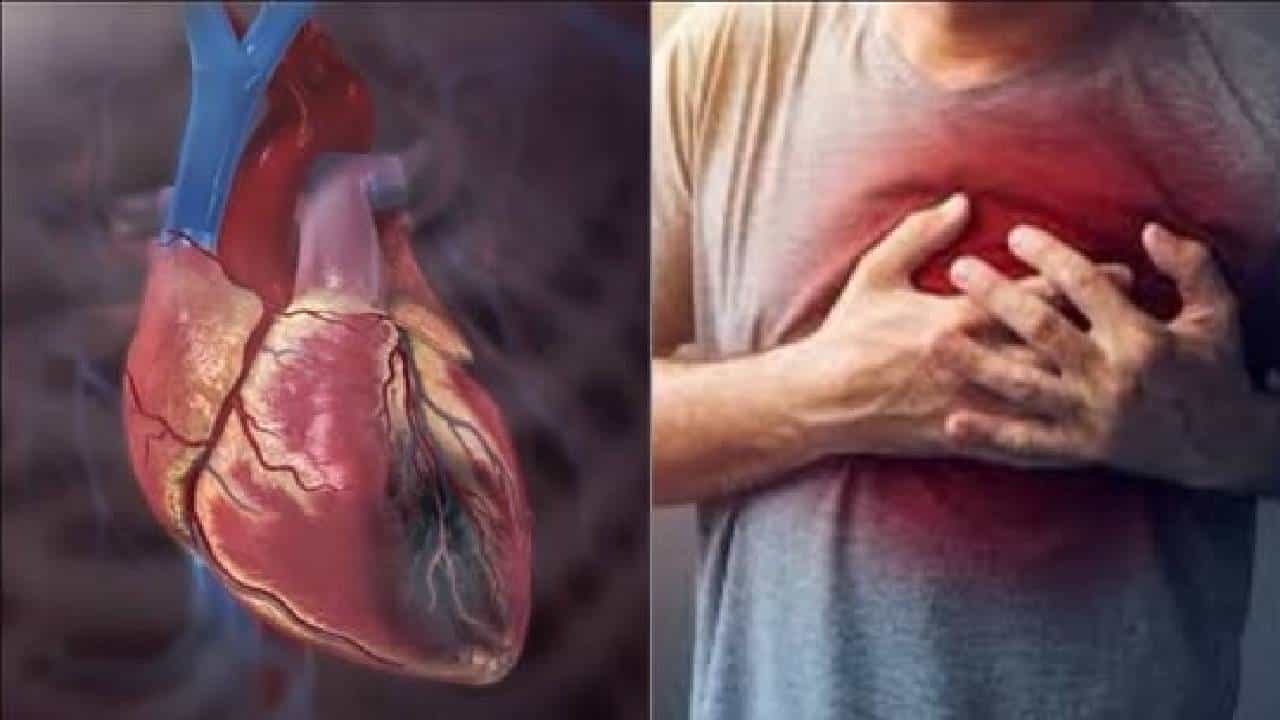 Cardiac Arrest: ಈ ಆಹಾರಗಳು ಹೃದಯ ಸ್ತಂಭನ ಸಂಭವಿಸಲು ಕಾರಣವಾಗಬಹುದು Cardiac Arrest: ಈ ಆಹಾರಗಳು ಹೃದಯ ಸ್ತಂಭನ ಸಂಭವಿಸಲು ಕಾರಣವಾಗಬಹುದು