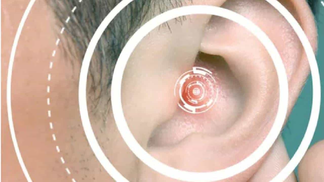 World Hearing Day 2022: ಕಿವಿ ಹೇಗೆ ಕೆಲಸ ಮಾಡುತ್ತದೆ? ಶ್ರವಣ ದೋಷಕ್ಕೆ ಕಾರಣಗಳೇನು ಎನ್ನುವುದನ್ನು ತಿಳಿಯಿರಿ World Hearing Day 2022: ಕಿವಿ ಹೇಗೆ ಕೆಲಸ ಮಾಡುತ್ತದೆ? ಶ್ರವಣ ದೋಷಕ್ಕೆ ಕಾರಣಗಳೇನು ಎನ್ನುವುದನ್ನು ತಿಳಿಯಿರಿ