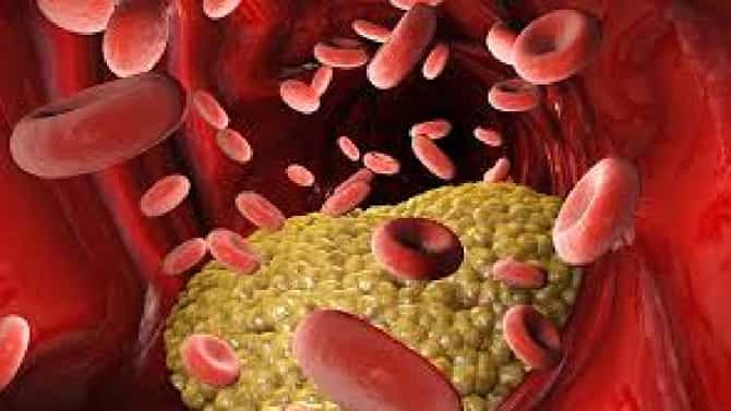 High Cholesterol: ಕೊಲೆಸ್ಟ್ರಾಲ್​ನ್ನು ನಿಯಂತ್ರಿಸಲು ಆಹಾರದಲ್ಲಿ ಯಾವ ಎಣ್ಣೆ ಬಳಸಬೇಕು ಗೊತ್ತಾ..! ಇಲ್ಲಿದೆ ಮಾಹಿತಿ