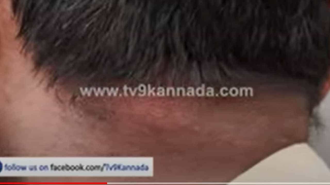 ಫ್ರೀಡಂ ಪಾರ್ಕ್, ಬೆಂಗಳೂರು: ಹೆಜ್ಜೇನು ದಾಳಿಯಲ್ಲಿ 10 ಪೊಲೀಸರಿಗೆ ಗಾಯ, ಇಬ್ಬರ ಸ್ಥಿತಿ ಗಂಭೀರ, ಆಸ್ಪತ್ರೆಗೆ ದಾಖಲು ಫ್ರೀಡಂ ಪಾರ್ಕ್, ಬೆಂಗಳೂರು: ಹೆಜ್ಜೇನು ದಾಳಿಯಲ್ಲಿ 10 ಪೊಲೀಸರಿಗೆ ಗಾಯ, ಇಬ್ಬರ ಸ್ಥಿತಿ ಗಂಭೀರ, ಆಸ್ಪತ್ರೆಗೆ ದಾಖಲು