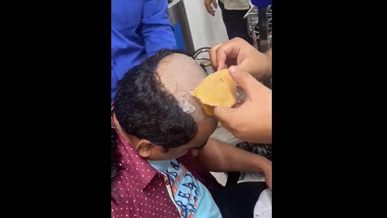 ತಲೆಗೂದಲಿನಲ್ಲಿ ಬಚ್ಚಿಟ್ಟು ಚಿನ್ನ ಕಳ್ಳಸಾಗಣೆ ಮಾಡುತ್ತಿದ್ದ ವ್ಯಕ್ತಿ ಸೆರೆ; ವಿಡಿಯೋ