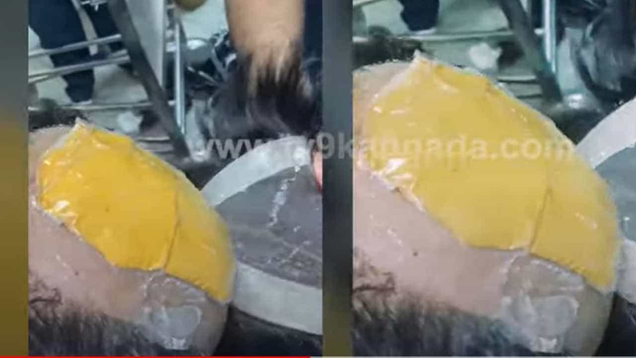 ಅವನು ವಿಗ್ ಮತ್ತು ಉಲ್ಲೇಖಿಸಲಾದ ಜಾಗದಲ್ಲಿ ಚಿನ್ನವನ್ನಿಟ್ಟುಕೊಂಡು ಕಸ್ಟಮ್ಸ್ ಅಧಿಕಾರಿಗಳಿಂದ ತಪ್ಪಿಸಿಕೊಳ್ಳುವ ಹವಣಿಕೆಯಲ್ಲಿದ್ದ! ಅವನು ವಿಗ್ ಮತ್ತು ಉಲ್ಲೇಖಿಸಲಾದ ಜಾಗದಲ್ಲಿ ಚಿನ್ನವನ್ನಿಟ್ಟುಕೊಂಡು ಕಸ್ಟಮ್ಸ್ ಅಧಿಕಾರಿಗಳಿಂದ ತಪ್ಪಿಸಿಕೊಳ್ಳುವ ಹವಣಿಕೆಯಲ್ಲಿದ್ದ!