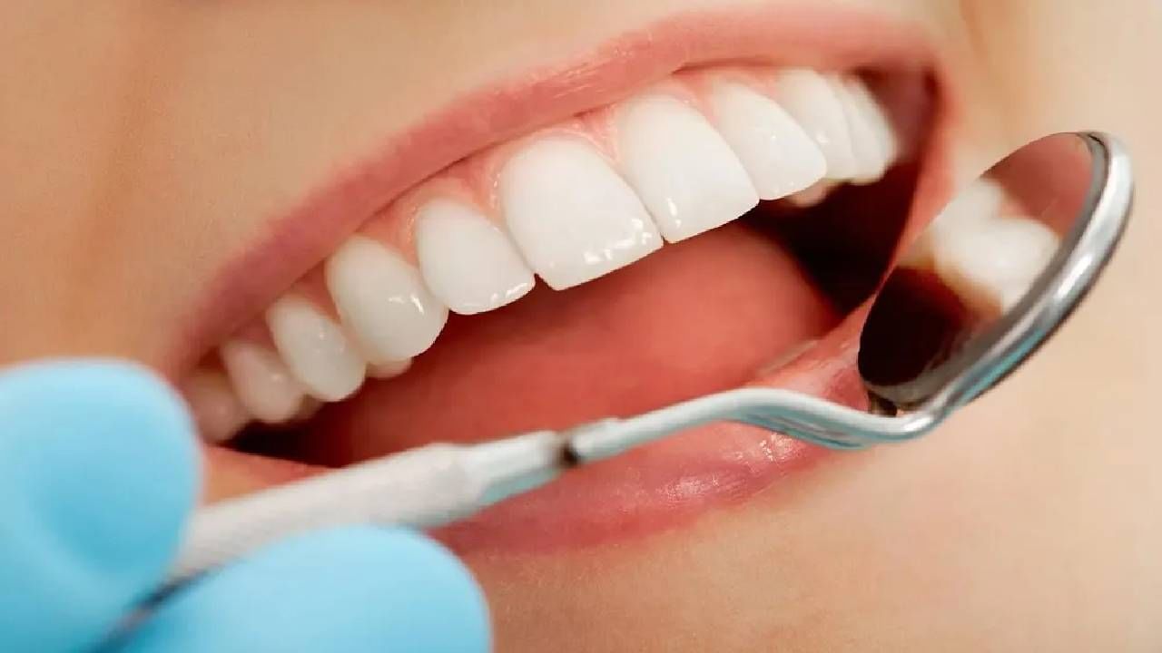 Dental Health: ಹಲ್ಲಿನ ಬಣ್ಣ ಬದಲಾಯಿಸುವ ಈ ಆಹಾರಗಳಿಂದ ದೂರವಿರಿ