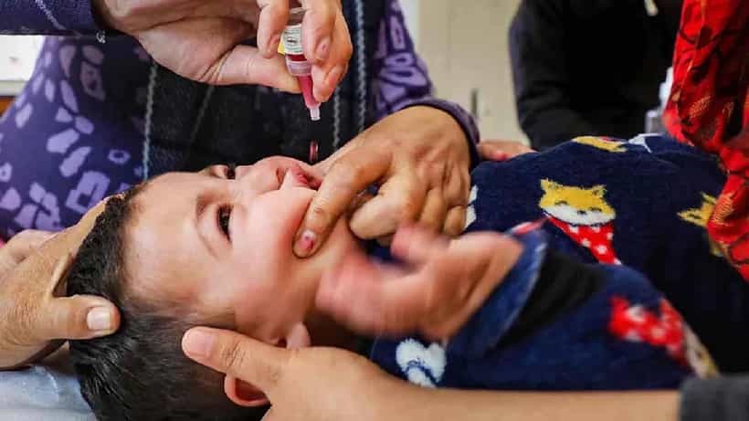 Wild Poliovirus: ವೈಲ್ಡ್ ಪೋಲಿಯೋವೈರಸ್ ಎಂದರೇನು? ಲಕ್ಷಣಗಳೇನು? ಹೇಗೆ ಹರಡುತ್ತೆ?