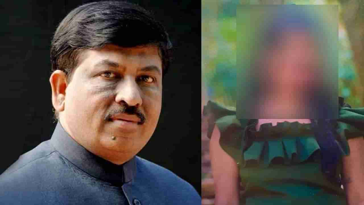 ಆಸಿಡ್ ದಾಳಿಗೆ ತುತ್ತಾದ ಯುವತಿಯ ವೈದ್ಯಕೀಯ ಚಿಕಿತ್ಸೆಗೆ ₹1 ಲಕ್ಷ ಪರಿಹಾರ ಘೋಷಿಸಿದ ಸಚಿವ ಮುರುಗೇಶ್ ನಿರಾಣಿ