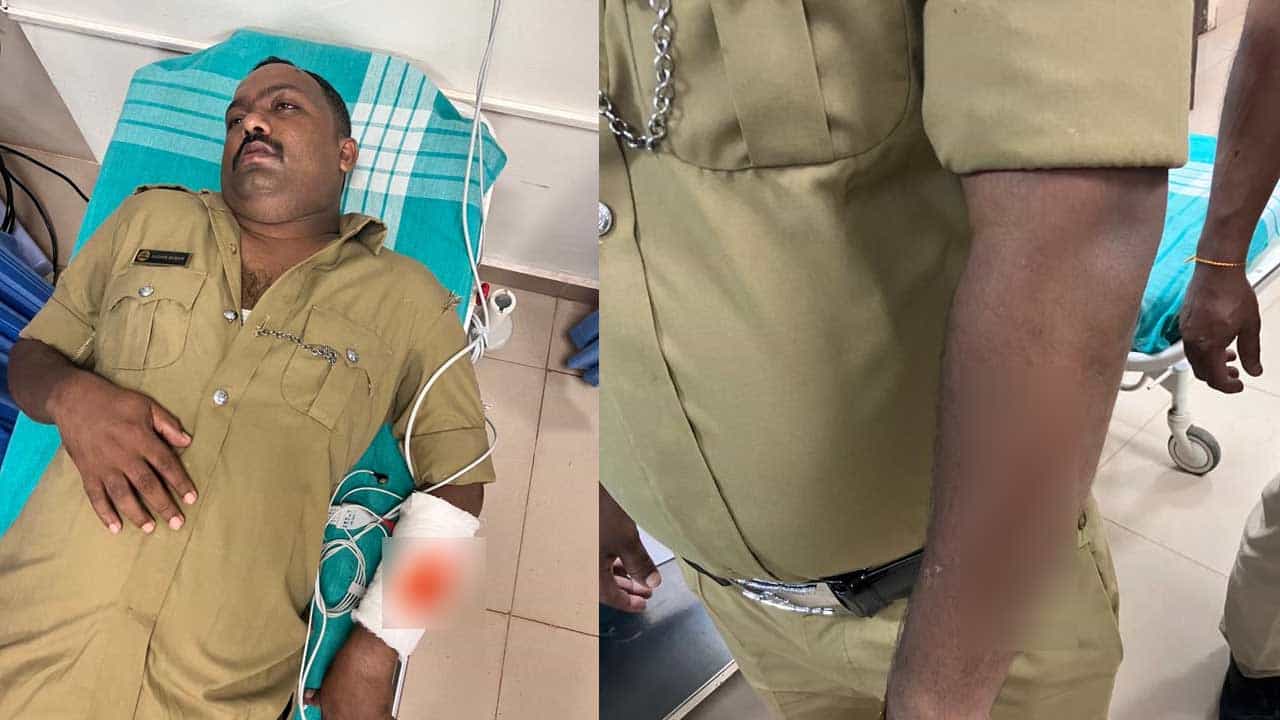 ಮಂಗಳೂರಿನಲ್ಲಿ ಕೊಲೆ ಆರೋಪಿಗಳ ಮೇಲೆ ಪೊಲೀಸರಿಂದ ಫೈರಿಂಗ್! ಆಸ್ಪತ್ರೆ ಐಸಿಯುನಲ್ಲಿ ಆರೋಪಿಗಳಿಗೆ ಚಿಕಿತ್ಸೆ ಮಂಗಳೂರಿನಲ್ಲಿ ಕೊಲೆ ಆರೋಪಿಗಳ ಮೇಲೆ ಪೊಲೀಸರಿಂದ ಫೈರಿಂಗ್! ಆಸ್ಪತ್ರೆ ಐಸಿಯುನಲ್ಲಿ ಆರೋಪಿಗಳಿಗೆ ಚಿಕಿತ್ಸೆ