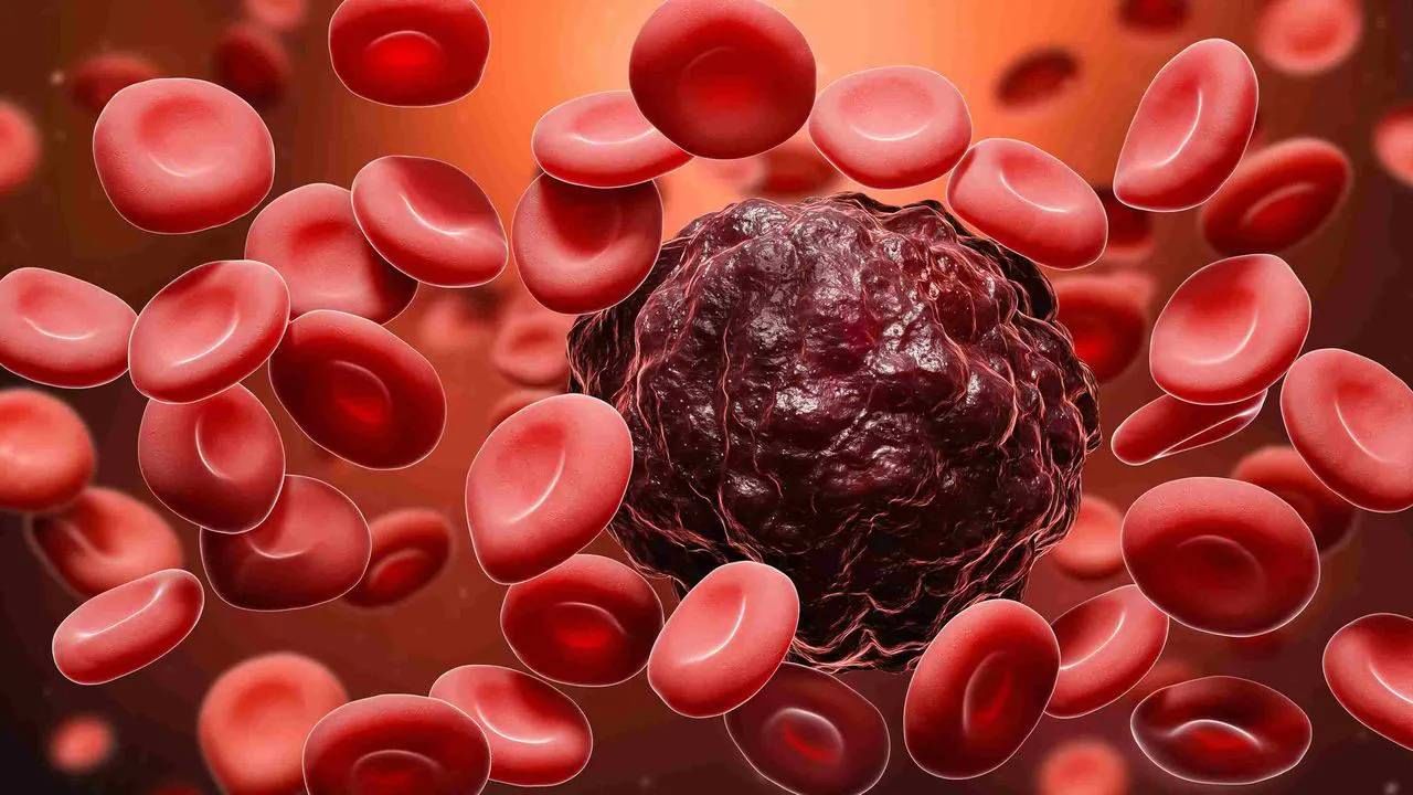 Blood Cancer: ದೀರ್ಘಕಾಲದ ಗಂಟಲು ಕೆರೆತ ಕ್ಯಾನ್ಸರ್​ನ ಲಕ್ಷಣವೇ?