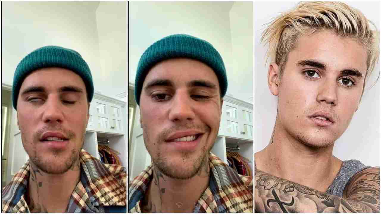 Justin Bieber: ವೈರಸ್​ನಿಂದ ಜಸ್ಟಿನ್​ ಬೀಬರ್​ ಮುಖಕ್ಕೆ ಪಾರ್ಶ್ವವಾಯು; ಖ್ಯಾತ ಗಾಯಕನಿಗೆ ಕಾಡುತ್ತಿದೆ ಗಂಭೀರ ಸಮಸ್ಯೆ