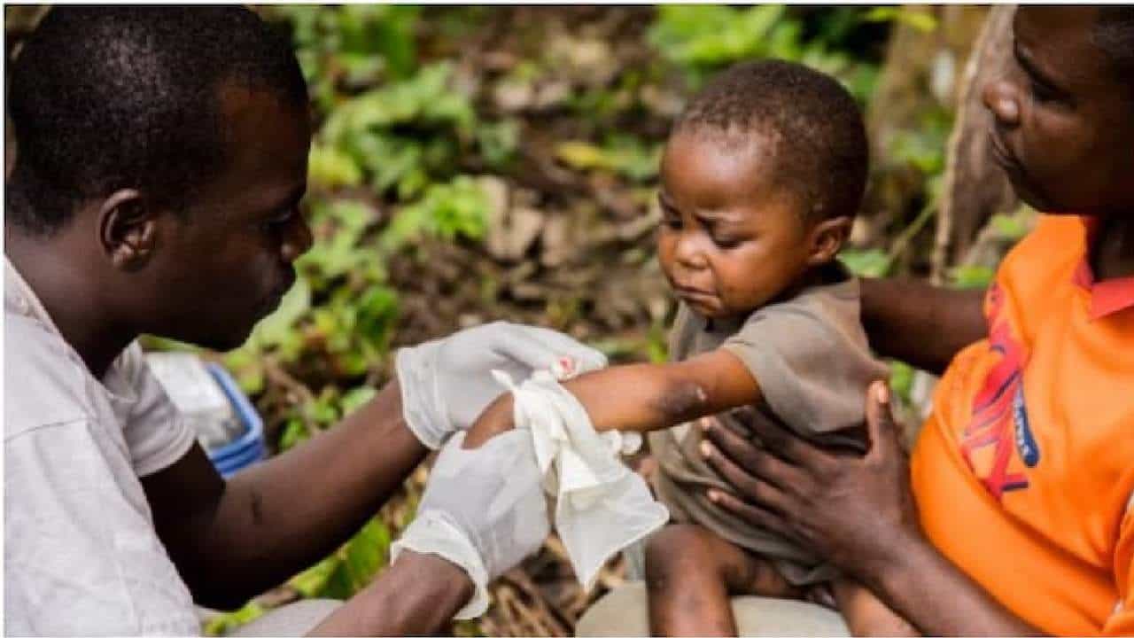 Monkeypox: ಮಂಕಿಪಾಕ್ಸ್ ಸೋಂಕನ್ನು ಸಾಂಕ್ರಾಮಿಕ ರೋಗವೆಂದು ಘೋಷಣೆ Monkeypox: ಮಂಕಿಪಾಕ್ಸ್ ಸೋಂಕನ್ನು ಸಾಂಕ್ರಾಮಿಕ ರೋಗವೆಂದು ಘೋಷಣೆ