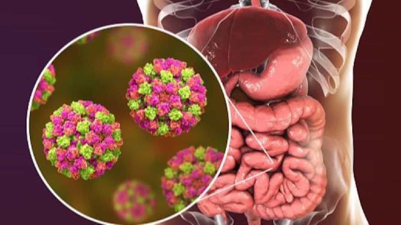 Norovirus: ನೊರೊವೈರಸ್ ರೋಗದ ಲಕ್ಷಣಗಳೇನು? ಸೋಂಕು ಹರಡುವಿಕೆಯನ್ನು ತಡೆಗಟ್ಟುವುದು ಹೇಗೆ? Norovirus: ನೊರೊವೈರಸ್ ರೋಗದ ಲಕ್ಷಣಗಳೇನು? ಸೋಂಕು ಹರಡುವಿಕೆಯನ್ನು ತಡೆಗಟ್ಟುವುದು ಹೇಗೆ?