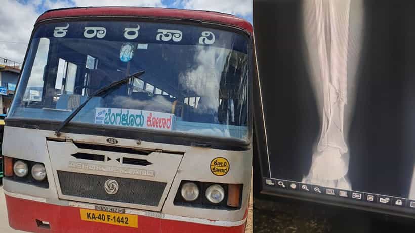ಏಕಾಏಕಿ ಹಂಪ್ ಎಗರಿಸಿದ ಕೆಎಸ್ಆರ್ಟಿಸಿ ಬಸ್ ಚಾಲಕ: ಕೆಳಗೆ ಬಿದ್ದು ಕಾಲು ಮುರಿದುಕೊಂಡ ಕಂಡಕ್ಟರ್