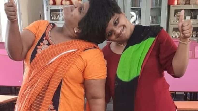 ಫಸ್ಟ್ ಕ್ಲಾಸ್ನಲ್ಲಿ ದ್ವಿತೀಯ ಪಿಯುಸಿ ಪಾಸಾದ ಹೈದರಾಬಾದ್ನ ಸಯಾಮಿ ಅವಳಿಗಳು