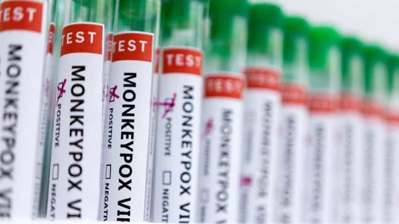 Monkeypox in Kerala: ಕೇರಳದ ಮಲಪ್ಪುರಂನಲ್ಲಿ 3ನೇ ಮಂಕಿಪಾಕ್ಸ್ ಪ್ರಕರಣ ಪತ್ತೆ Monkeypox in Kerala: ಕೇರಳದ ಮಲಪ್ಪುರಂನಲ್ಲಿ 3ನೇ ಮಂಕಿಪಾಕ್ಸ್ ಪ್ರಕರಣ ಪತ್ತೆ