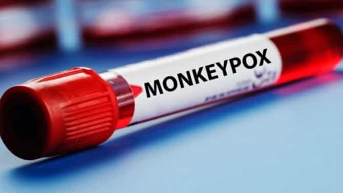 Monkeypox ಕೇರಳದಲ್ಲಿ ಮತ್ತೊಂದು ಮಂಕಿಪಾಕ್ಸ್ ಪ್ರಕರಣ ಪತ್ತೆ, ಸೋಂಕಿತರ ಸಂಖ್ಯೆ 5ಕ್ಕೆ ಏರಿಕೆ