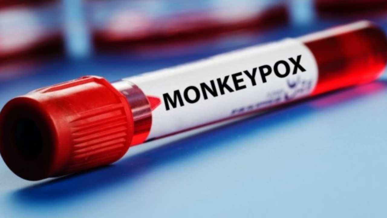 Monkeypox Death: ಕೇರಳದಲ್ಲಿ ಮಂಕಿಪಾಕ್ಸ್​ಗೆ ಮೊದಲ ಬಲಿ, ಆರೋಗ್ಯ ಸಚಿವರಿಂದ ಸ್ಪಷ್ಟನೆ