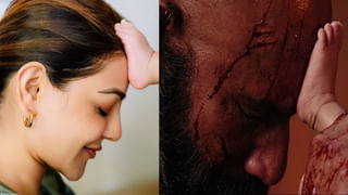 ಶೂಟಿಂಗ್ ವೇಳೆ ಎಡವಟ್ಟು; ತೀವ್ರವಾಗಿ ಗಾಯಗೊಂಡ ತಮಿಳು ನಟ ವಿಶಾಲ್