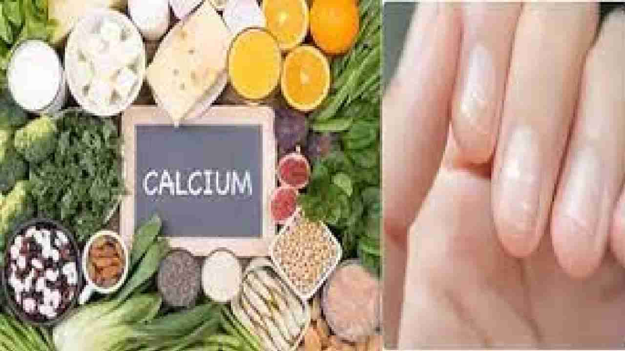 Calcium Deficiency: ದೇಹದಲ್ಲಿ ಗೋಚರಿಸುವ ಈ ರೋಗಲಕ್ಷಣಗಳನ್ನು ನಿರ್ಲಕ್ಷಿಸಬೇಡಿ, ಕ್ಯಾಲ್ಸಿಯಂ ಕೊರತೆ ಇರಬಹುದು