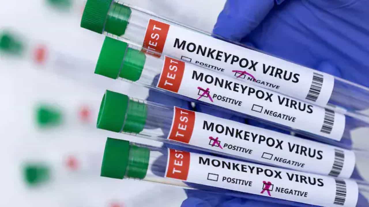 Monkeypox: ಮನೆಯಲ್ಲಿ ಉಪಯೋಗ ಮಾಡುವ ವಸ್ತುಗಳಿಂದ ಮಂಕಿಪಾಕ್ಸ್ ಹರಡುವಿಕೆ? : ಹೊಸ ಅಧ್ಯಯನ ಹೇಳಿದ್ದೇನು ಗೊತ್ತಾ? Monkeypox: ಮನೆಯಲ್ಲಿ ಉಪಯೋಗ ಮಾಡುವ ವಸ್ತುಗಳಿಂದ ಮಂಕಿಪಾಕ್ಸ್ ಹರಡುವಿಕೆ? : ಹೊಸ ಅಧ್ಯಯನ ಹೇಳಿದ್ದೇನು ಗೊತ್ತಾ?