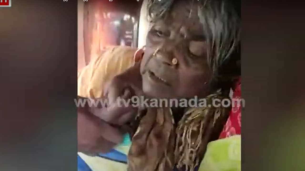 ಕಲಬುರಗಿ: ಚಿಂಚೋಳಿಯಲ್ಲಿ ವೃದ್ಧೆಯೊಬ್ಬಳನ್ನು ಮಕ್ಕಳ ಕಳ್ಳಿ ಅಂತ ಭಾವಿಸಿ ಥಳಿತ! ಕಲಬುರಗಿ: ಚಿಂಚೋಳಿಯಲ್ಲಿ ವೃದ್ಧೆಯೊಬ್ಬಳನ್ನು ಮಕ್ಕಳ ಕಳ್ಳಿ ಅಂತ ಭಾವಿಸಿ ಥಳಿತ!