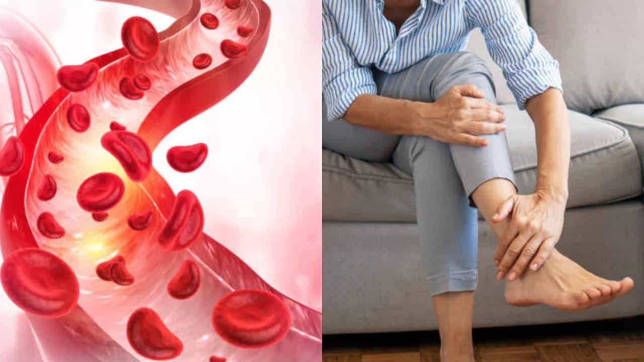 Cholesterol: ದೇಹದಲ್ಲಿ ಕೊಬ್ಬು ಹೆಚ್ಚಾದಾಗ, ನಿಮ್ಮ ಕಾಲುಗಳಲ್ಲಿ ಈ ಲಕ್ಷಣಗಳು ಗೋಚರಿಸುತ್ತೆ, ನಿರ್ಲಕ್ಷಿಸಬೇಡಿ Cholesterol: ದೇಹದಲ್ಲಿ ಕೊಬ್ಬು ಹೆಚ್ಚಾದಾಗ, ನಿಮ್ಮ ಕಾಲುಗಳಲ್ಲಿ ಈ ಲಕ್ಷಣಗಳು ಗೋಚರಿಸುತ್ತೆ, ನಿರ್ಲಕ್ಷಿಸಬೇಡಿ
