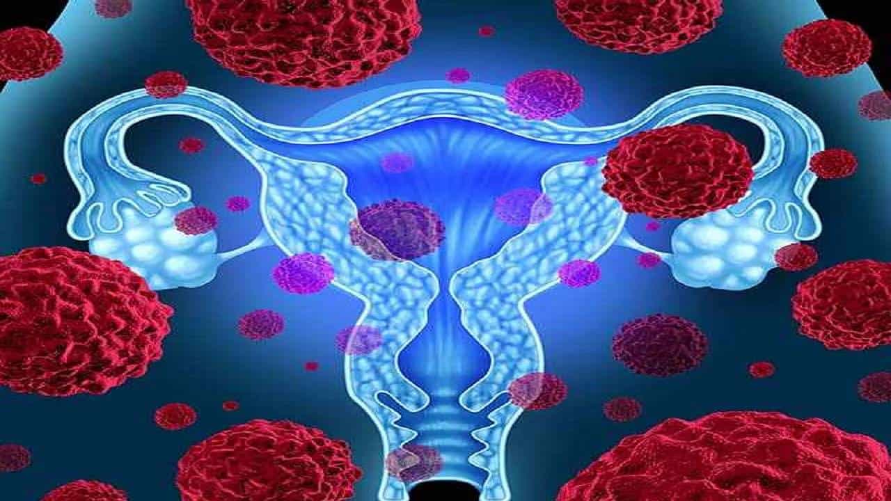 Cervical Cancer: ಗರ್ಭಕಂಠದ ಕ್ಯಾನ್ಸರ್ ಎಂದರೇನು? ಮಹಿಳೆಯರು ತಿಳಿಯಲೇಬೇಕಾದ ಕೆಲವು ಅಂಶಗಳು ಇಲ್ಲಿವೆ Cervical Cancer: ಗರ್ಭಕಂಠದ ಕ್ಯಾನ್ಸರ್ ಎಂದರೇನು? ಮಹಿಳೆಯರು ತಿಳಿಯಲೇಬೇಕಾದ ಕೆಲವು ಅಂಶಗಳು ಇಲ್ಲಿವೆ