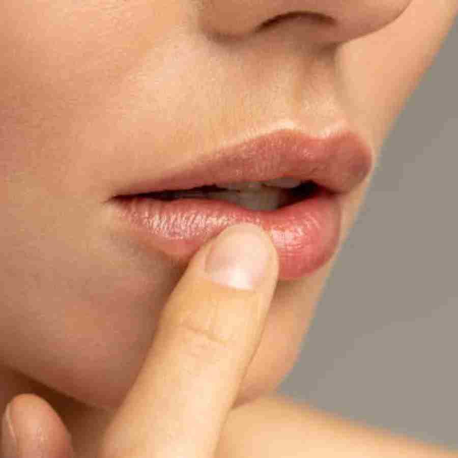 Health Tips black spots on the lips instead of smoking